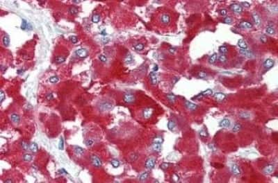 Immunohistochemistry-Paraffin: THEM6 Antibody [NBP3-14493]